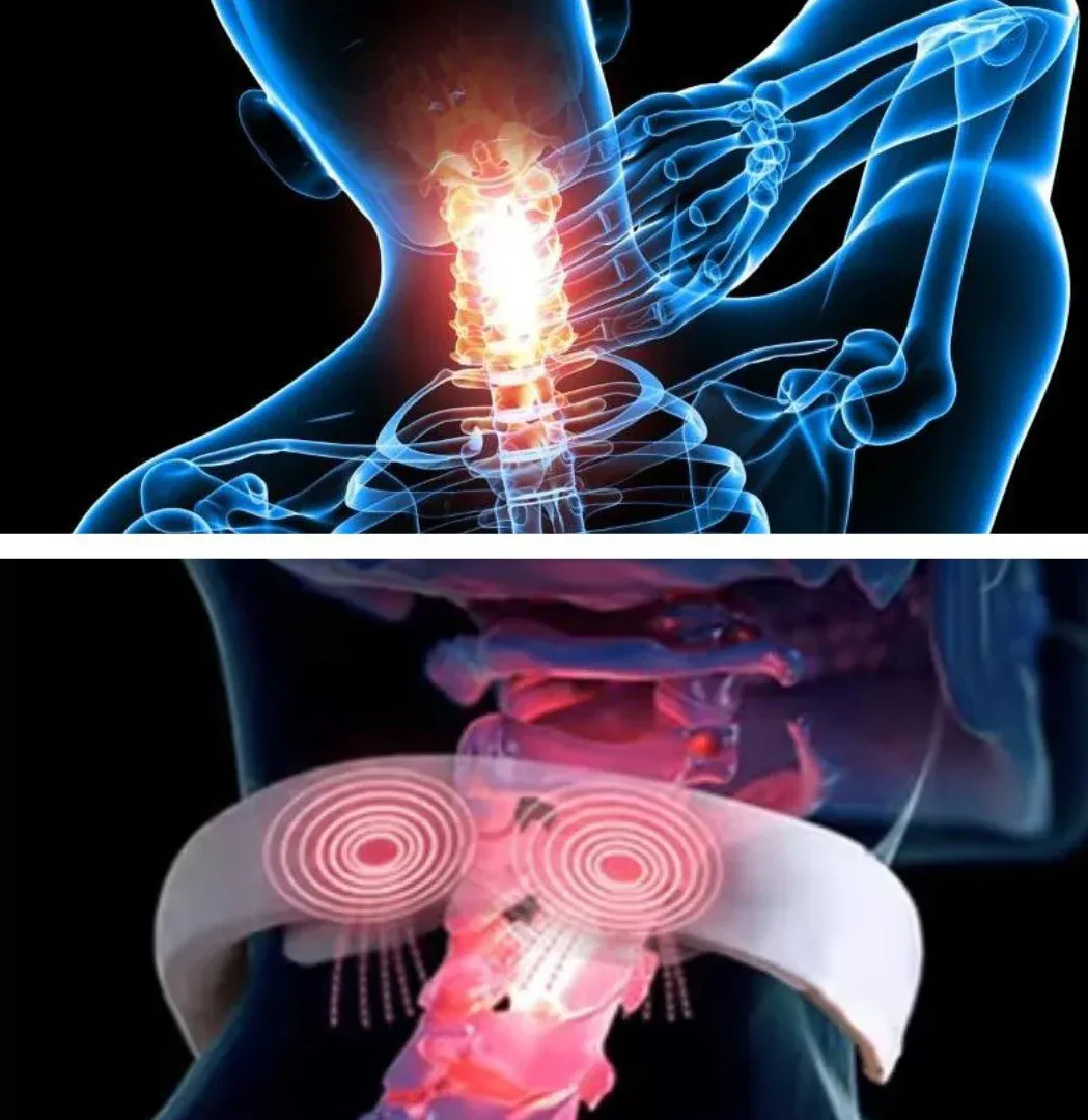 masseur de cou intelligent avec technologie à impulsions électriques masseur de cou intelligent avec technologie à impulsions électriques